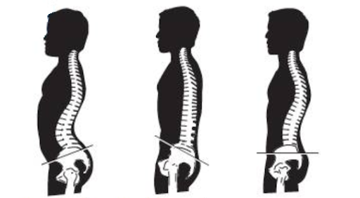 Preventing Low Back Pain